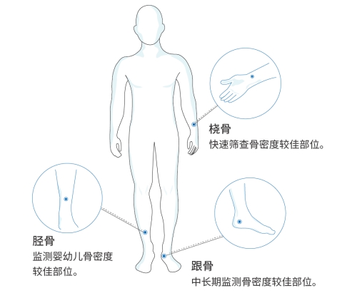 超聲骨密度測定儀檢測部位